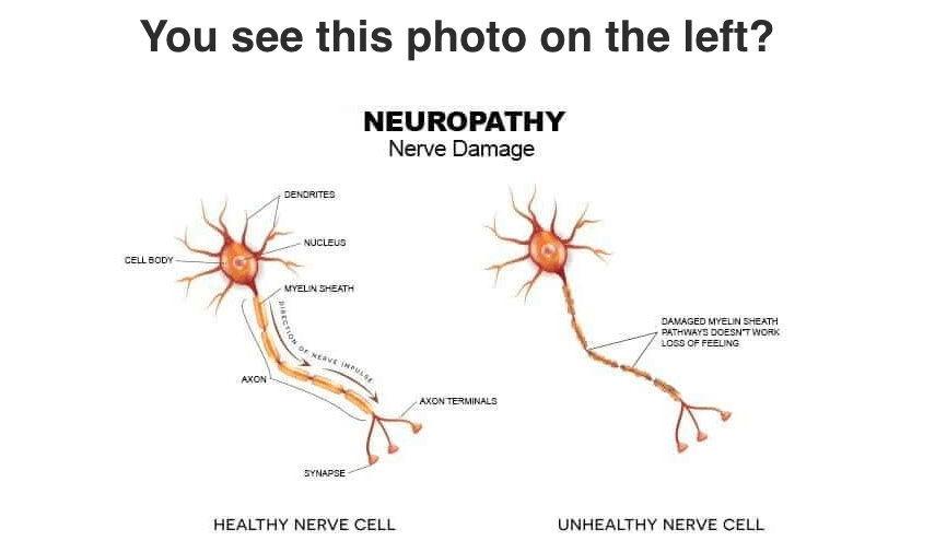 Nerve Fresh - Neuron